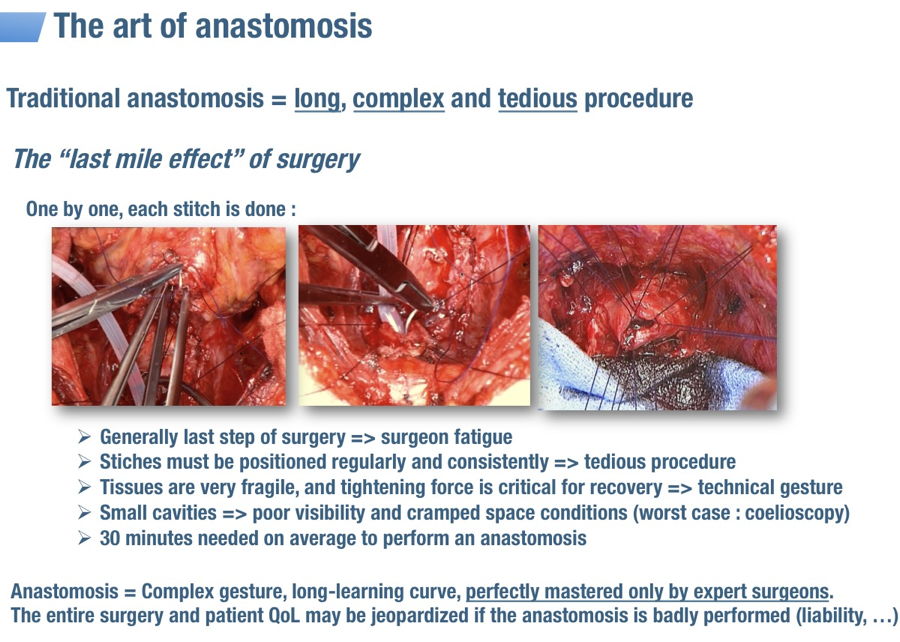 anastomosis is a complex gesture, long-learning curve, perfectly mastered only by expert surgeons.